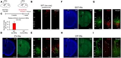 Whole-brain mapping of long-range inputs to the VIP-expressing inhibitory neurons in the primary motor cortex